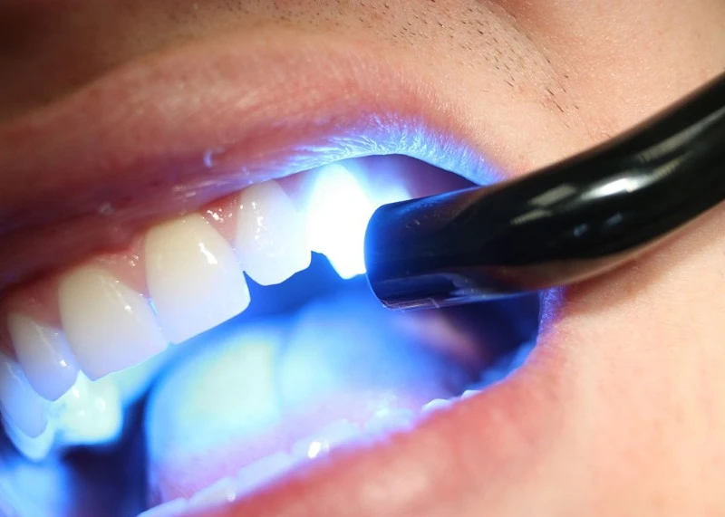 Dental Curing Lights Dental Curing Lights